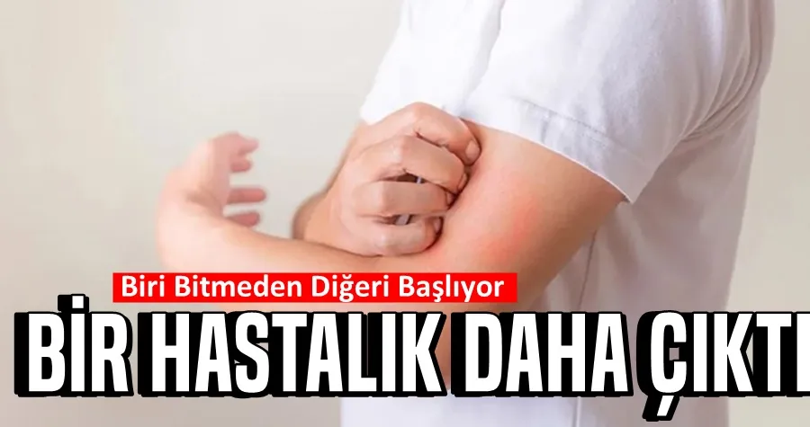 Bis Hastalık Daha Çıktı